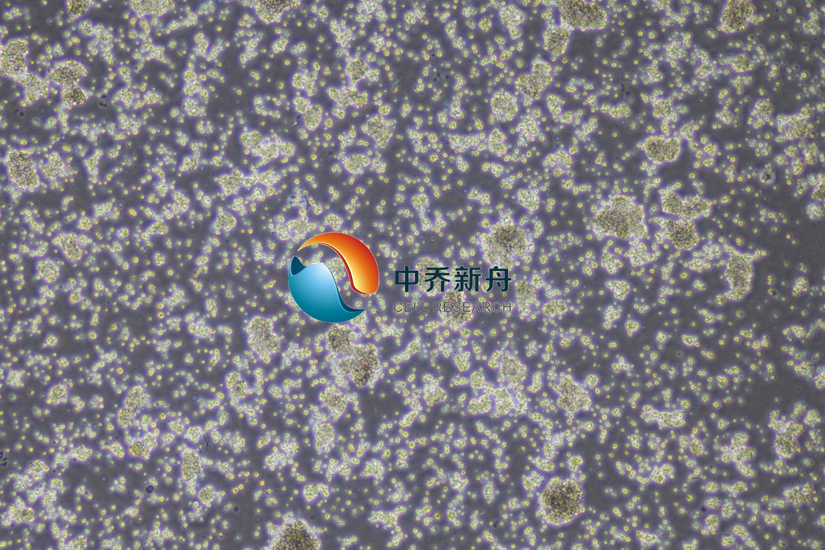 TMD8人弥漫性大B淋巴瘤细胞