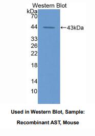小鼠天冬氨酸转氨酶(AST)多克隆抗体