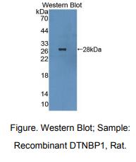 大鼠异连蛋白结合蛋白1(DTNBP1)多克隆抗体