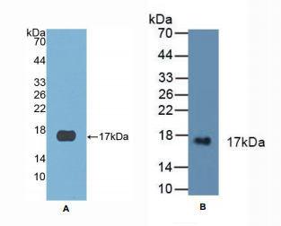 人半胱氨酸蛋白酶抑制剂6(CST6)多克隆抗体