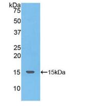 人神经激肽B(NKB)多克隆抗体