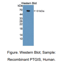 人前列腺素I合酶(PTGIS)多克隆抗体