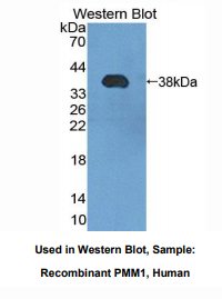 https://msimg.bioon.com/bionline/goods-no-pic.png