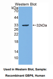 人鸟苷酸结合蛋白6(GBP6)多克隆抗体