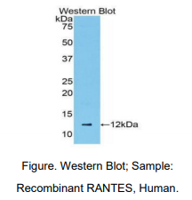 https://msimg.bioon.com/bionline/goods-no-pic.png