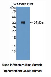 人氧固醇结合蛋白(OSBP)多克隆抗体