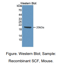 https://msimg.bioon.com/bionline/goods-no-pic.png