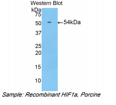 猪低氧诱导因子1α(HIF1a)多克隆抗体