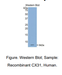 人间隙连接蛋白31(CX31)多克隆抗体