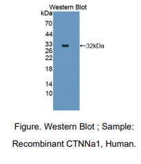人连环蛋白α1(CTNNa1)多克隆抗体