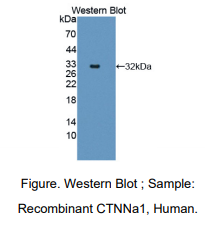 https://msimg.bioon.com/bionline/goods-no-pic.png