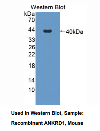 https://msimg.bioon.com/bionline/goods-no-pic.png