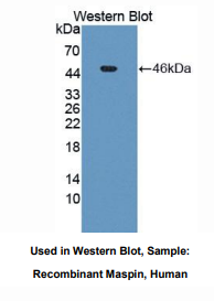 https://msimg.bioon.com/bionline/goods-no-pic.png