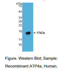 https://msimg.bioon.com/bionline/goods-no-pic.png