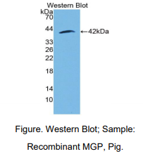 https://msimg.bioon.com/bionline/goods-no-pic.png