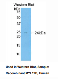 https://msimg.bioon.com/bionline/goods-no-pic.png