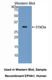 人肝配蛋白A受体1(EPHA1)多克隆抗体