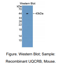 https://msimg.bioon.com/bionline/goods-no-pic.png