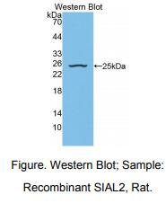 https://msimg.bioon.com/bionline/goods-no-pic.png