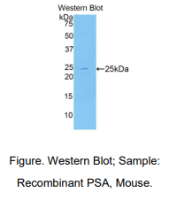 https://msimg.bioon.com/bionline/goods-no-pic.png