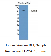 https://msimg.bioon.com/bionline/goods-no-pic.png