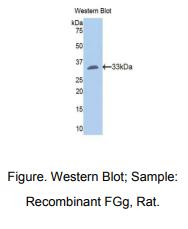 https://msimg.bioon.com/bionline/goods-no-pic.png