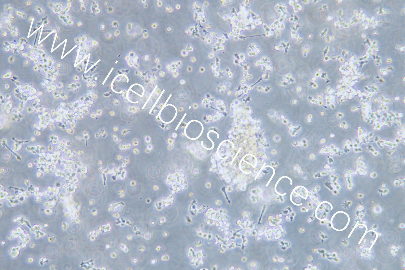 OCI-LY3细胞/OCILY3细胞/OCI-LY3/OCILY3/人弥漫大B细胞淋巴瘤细胞