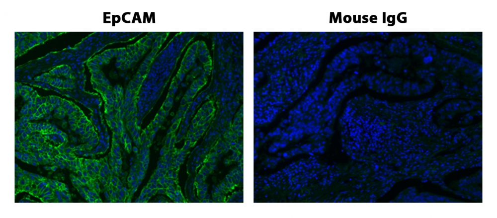 https://img.medsci.cn/e73eefcea40976357f460123cbf1e819c54e5106c9b457225be13b1cbc991aff.png