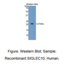 人唾液酸结合Ig样凝集素10(SIGLEC10)多克隆抗体