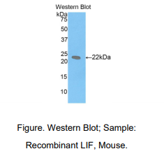 https://msimg.bioon.com/bionline/goods-no-pic.png