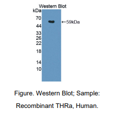 人甲状腺素受体α(THRa)多克隆抗体