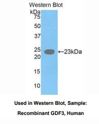 https://msimg.bioon.com/bionline/goods-no-pic.png