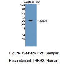 https://msimg.bioon.com/bionline/goods-no-pic.png