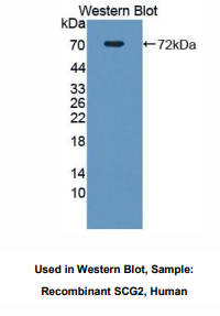 人分泌粒蛋白Ⅱ(SCG2)多克隆抗体