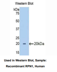 https://msimg.bioon.com/bionline/goods-no-pic.png