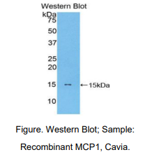 https://msimg.bioon.com/bionline/goods-no-pic.png