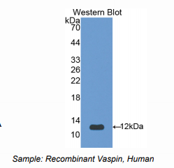 https://msimg.bioon.com/bionline/goods-no-pic.png