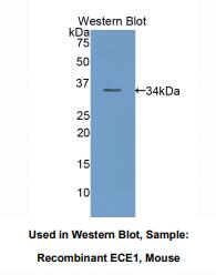 https://msimg.bioon.com/bionline/goods-no-pic.png