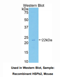 小鼠热休克蛋白β2(HSPb2)多克隆抗体