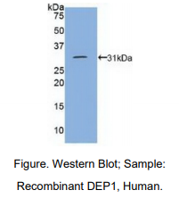 https://msimg.bioon.com/bionline/goods-no-pic.png