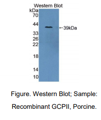 https://msimg.bioon.com/bionline/goods-no-pic.png