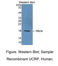 https://msimg.bioon.com/bionline/goods-no-pic.png