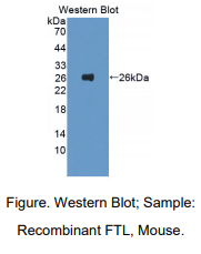 https://msimg.bioon.com/bionline/goods-no-pic.png