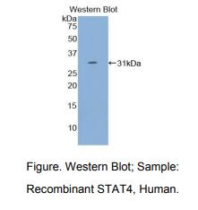 https://msimg.bioon.com/bionline/goods-no-pic.png