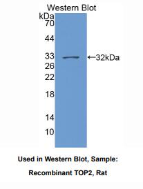 https://msimg.bioon.com/bionline/goods-no-pic.png