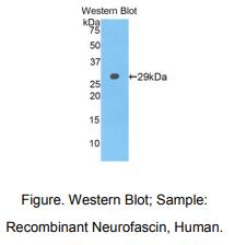 https://msimg.bioon.com/bionline/goods-no-pic.png