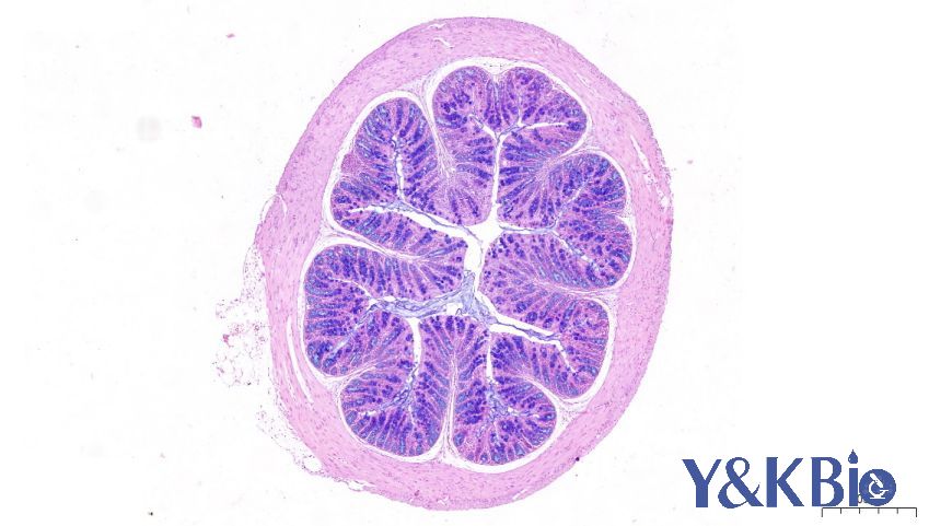 https://img.medsci.cn/09f7f9b396aaea8c5a2398de56f920980d508f8e7313325b130eae0a6c633bd4.png