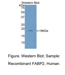 人肠型脂肪酸结合蛋白(FABP2)多克隆抗体