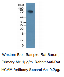 https://msimg.bioon.com/bionline/goods-no-pic.png