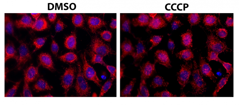 https://img.medsci.cn/e73eefcea40976357f460123cbf1e819c54e5106c9b457225be13b1cbc991aff.png